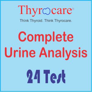 Complete Urine Analysis
